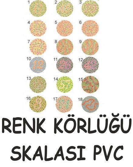 Renk Korlugu Medikaltec Kitabi: Yeni Başlayanlar İçin Temel Bilgiler + Kontrol Listesi