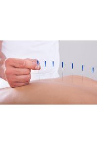 Akupunktur Iğnesikuru Iğne,acupuncture Needle 0,30*40mm