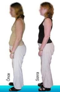 Medikaltec BackTone Duruş Düzeltici Medium Beden