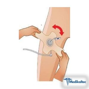 Medikaltec Anjiyo Bandı Medikaltec1360 - Görsel 2 (Ön görünüm)