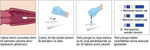 AmniSure Fetal Membran Yırtığı Testi Amn - Medikaltec AmniSure Fetal Membran Yırtığı Testi Medikaltec7995 - Görsel 2 (Ön…