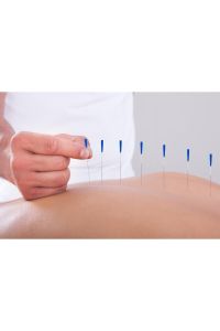 Akupunktur Iğnesikuru Iğne,acupuncture Needle 0.20*13mm