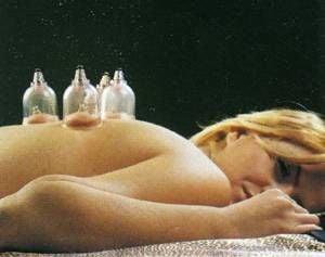 Medikaltec Hacamat Kupa Seti Kupa Çekme Aleti 24 Lü KUPA