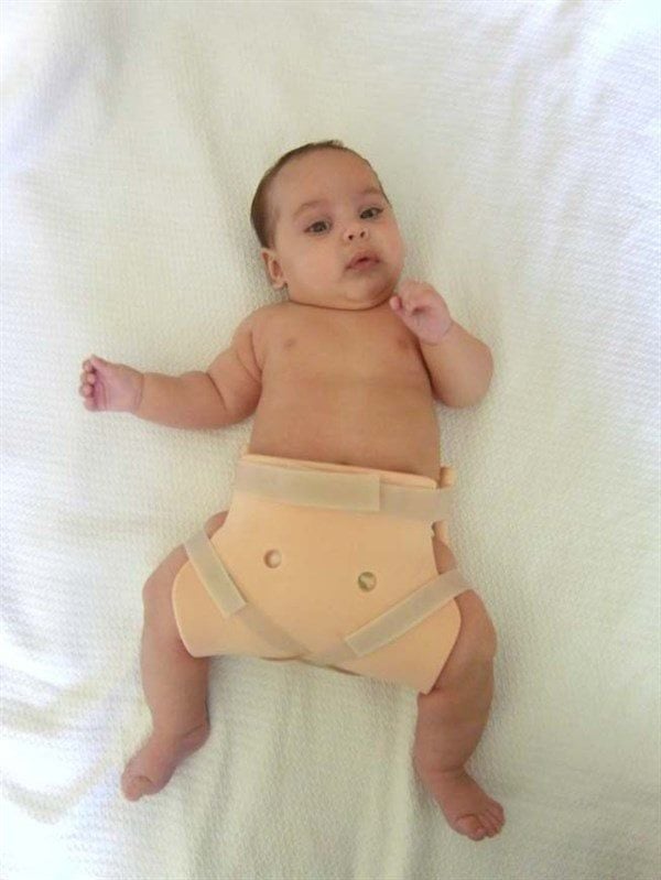 Frejka Yastığı Kalça Çıkığı Yastığı Yaş  - Medikaltec Frejka Yastığı Kalça Çıkığı Yastığı Yaş Aralı 0-1 Yaş Arası