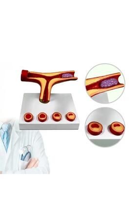 Medikaltec Damar Tıkanıklığı Model46 – D - Medikaltec Damar Tıkanıklığı Model46