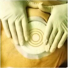 Coloplast (10 Adet) 33353 Comfeel Plus B - Coloplast ( Adet) Comfeel Plus Basınç ıcı Hidrokolloid Yara Örtüsü Cm