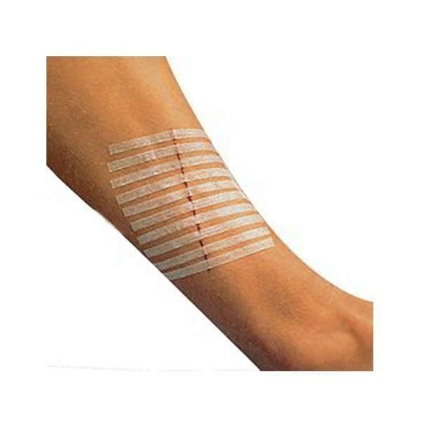 Steri Strip 10 Adet STERİ STRİP Steril s - Medikaltec Steri Strip Adet Medikaltec7194 - Görsel 1 (Ön görünüm)