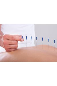 Medikaltec Akupunktur Iğnesikuru Iğne,acupuncture Needle 0,35*60mm