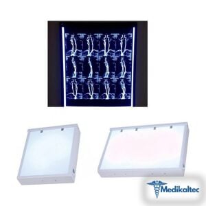 Negatoskop İkili